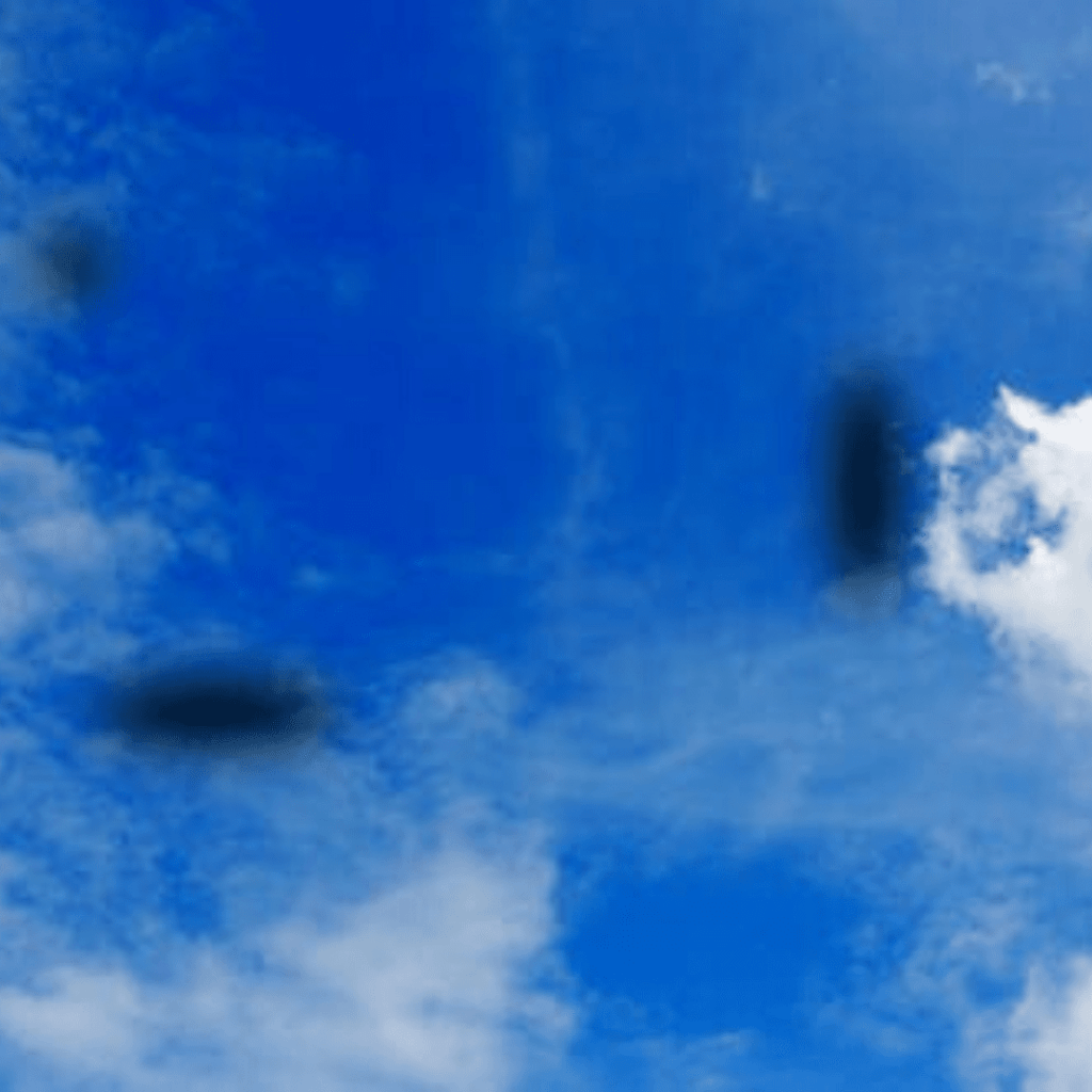 Uveitis Treatment in Ayurveda Natural Eye Inflammation Relief