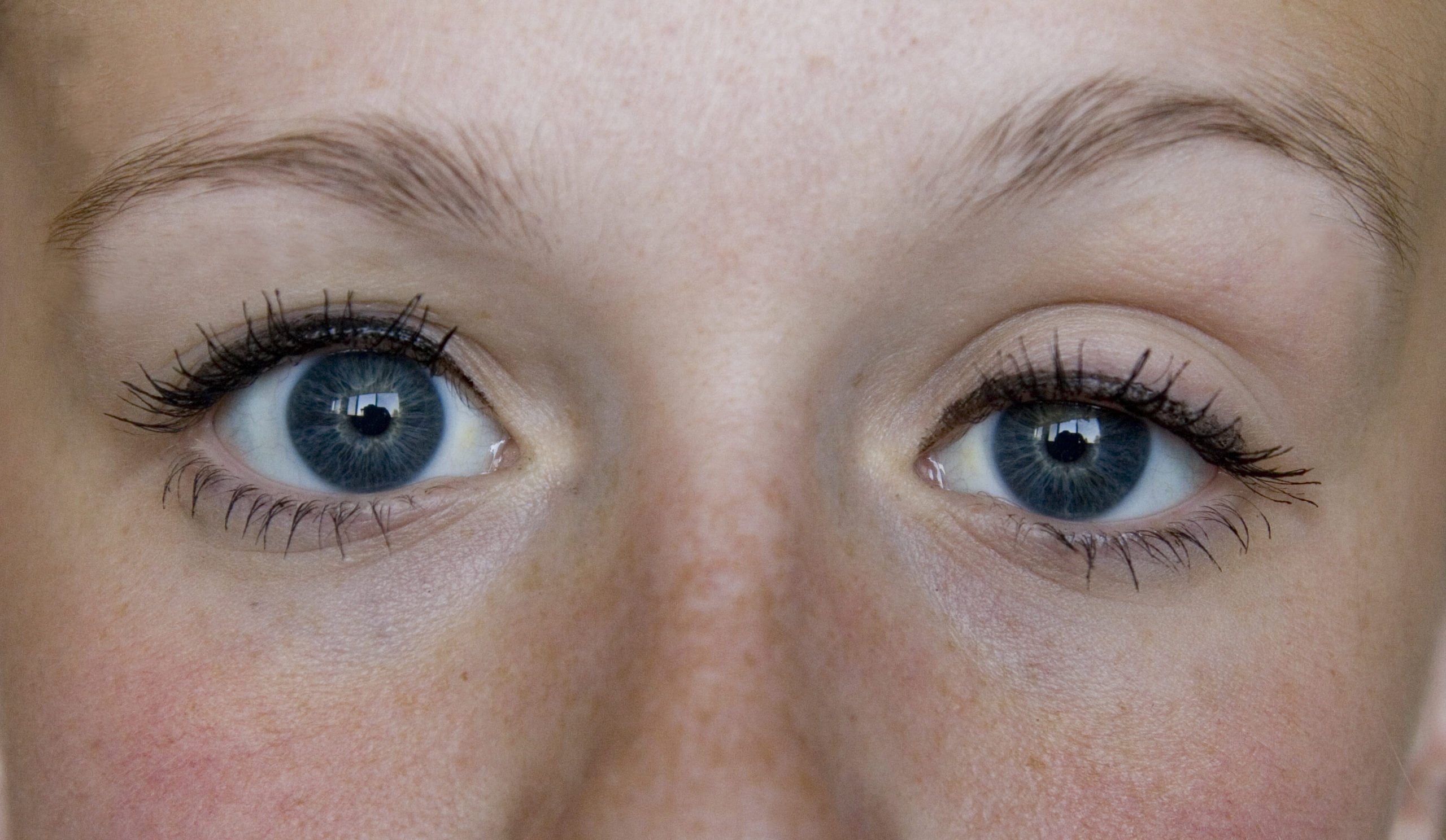 Natural Cure for Lazy Eye