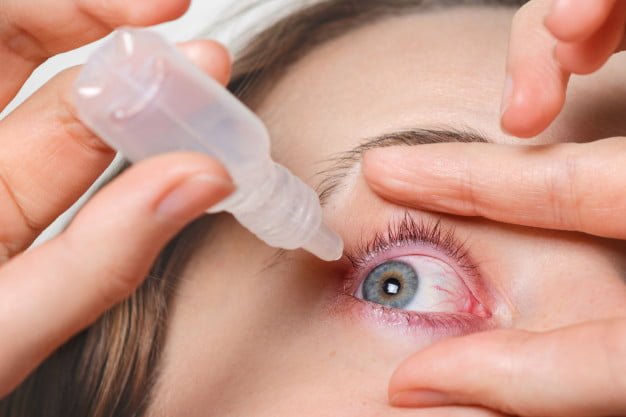Eye Dryness