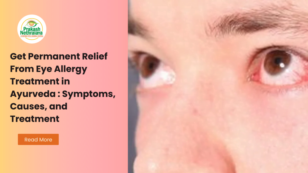 Ayurvedic Treatment for Eye Allergy & Conjunctivitis